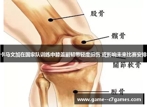 卡马文加在国家队训练中膝盖副韧带轻度扭伤 或影响未来比赛安排 卡马文加在国家队训练中膝盖副韧带轻度扭伤 或影响未来比赛安排